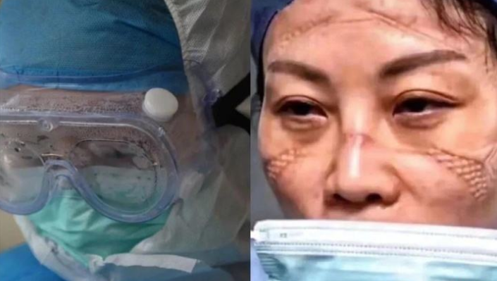 【鋼城文苑】抗“疫”前線的開拓者